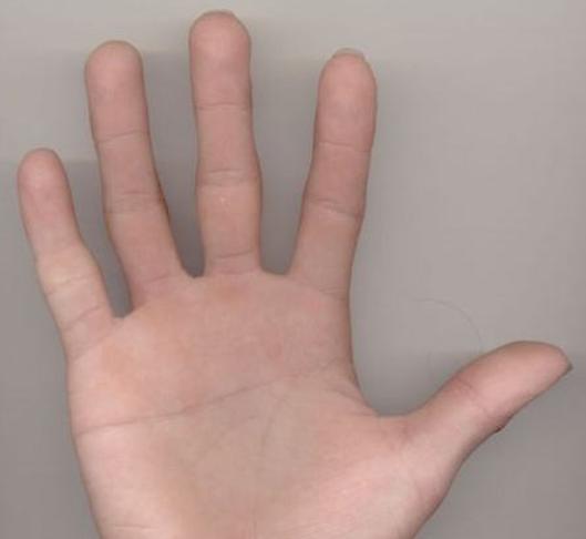 断掌纹女孩,女孩左手断掌纹