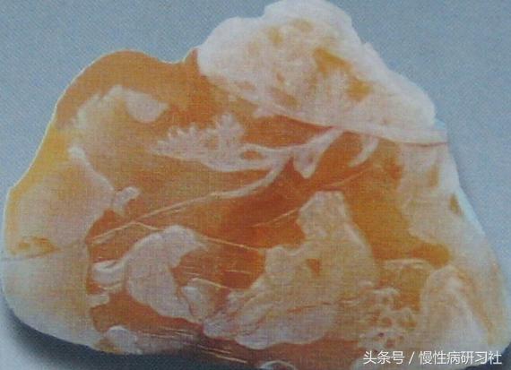 央视曝光肝胆排毒骗局,肝胆排毒骗局央视报道