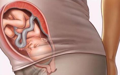 预产期临近,阵痛明显,胎儿不入盆怎么办?听听专家怎么说