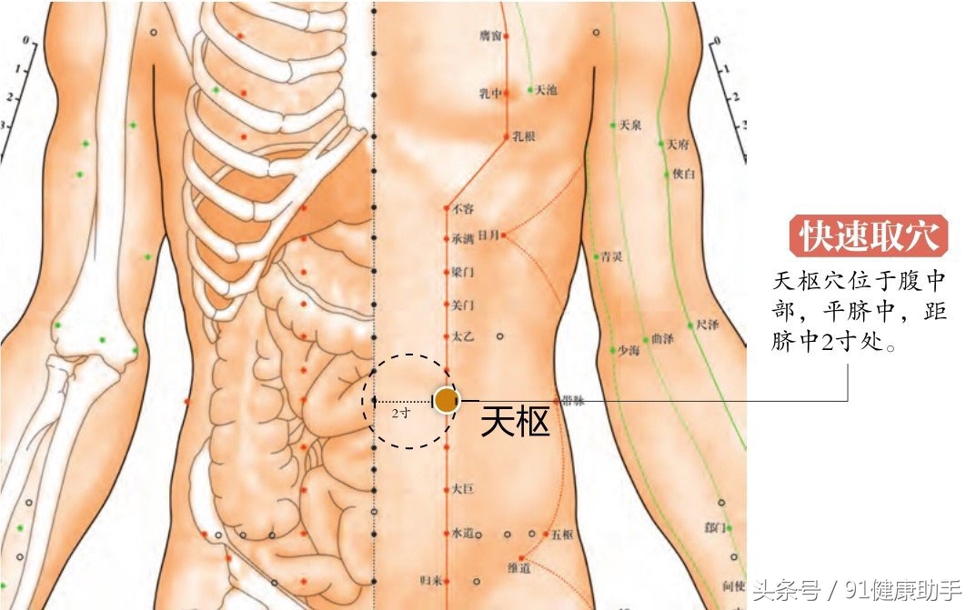 中医治疗阑尾炎穴位处方,阑尾炎针灸调理穴位图
