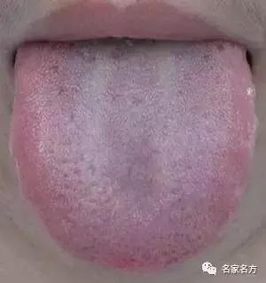 舌头是人体健康的晴雨表,舌头是健康的信号灯