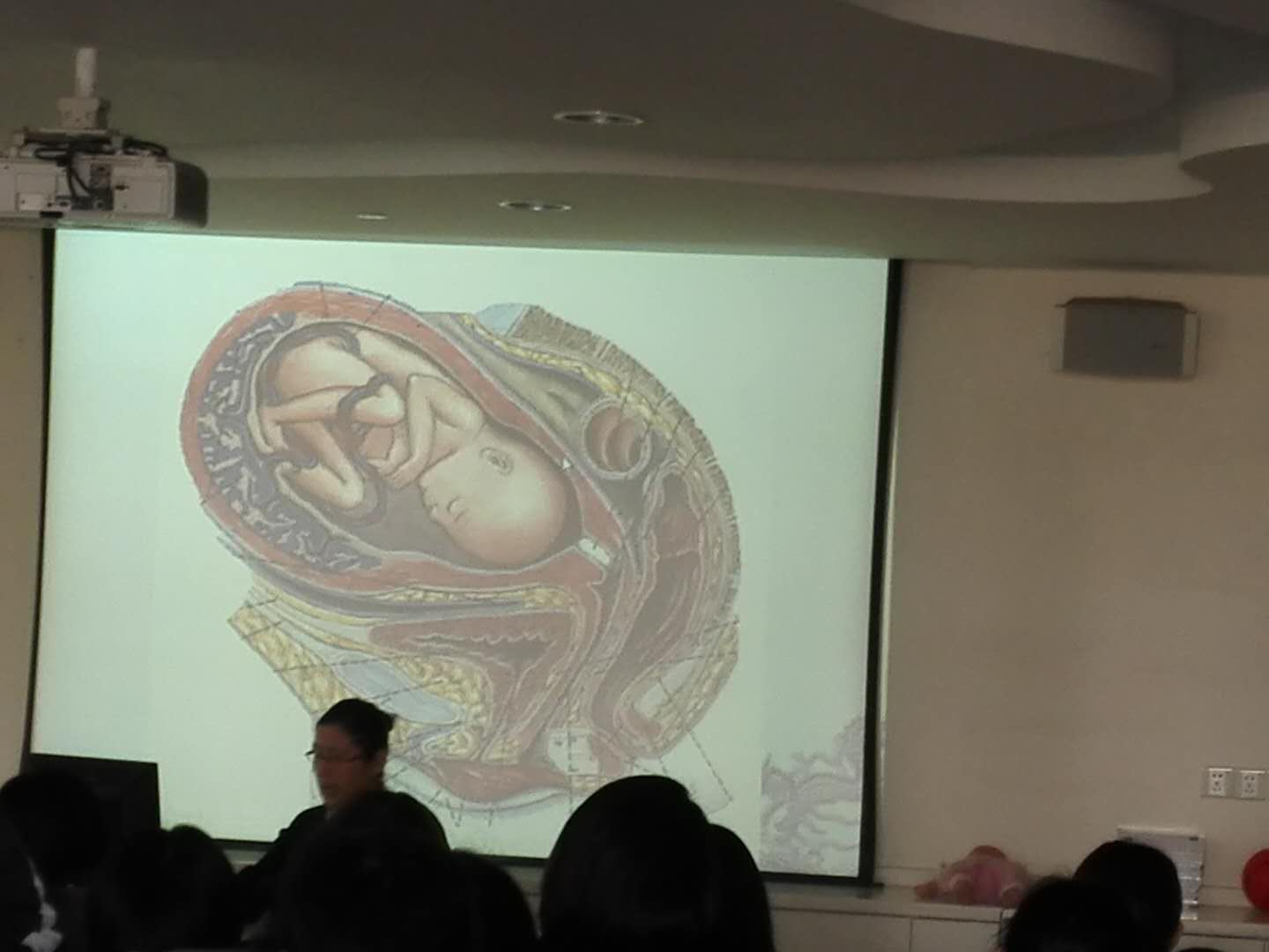 自然分娩不打无痛顺产的全部过程,顺产是通过产道自然分娩吗