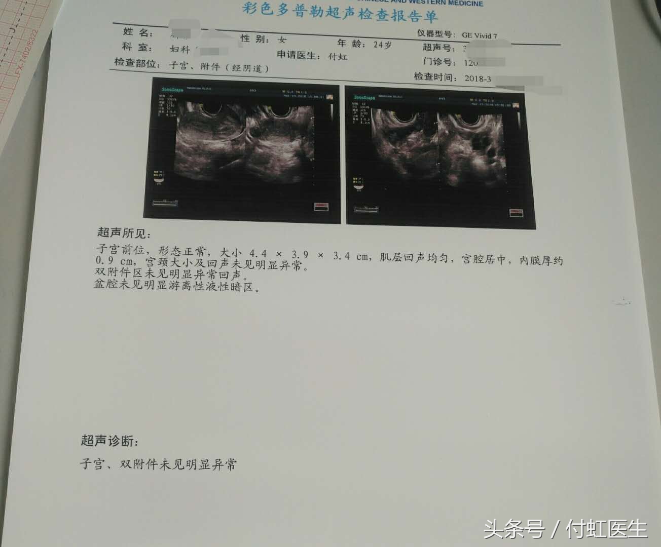 人流术后3天腰疼腹部疼,人流后留下后遗症腰酸怎么办