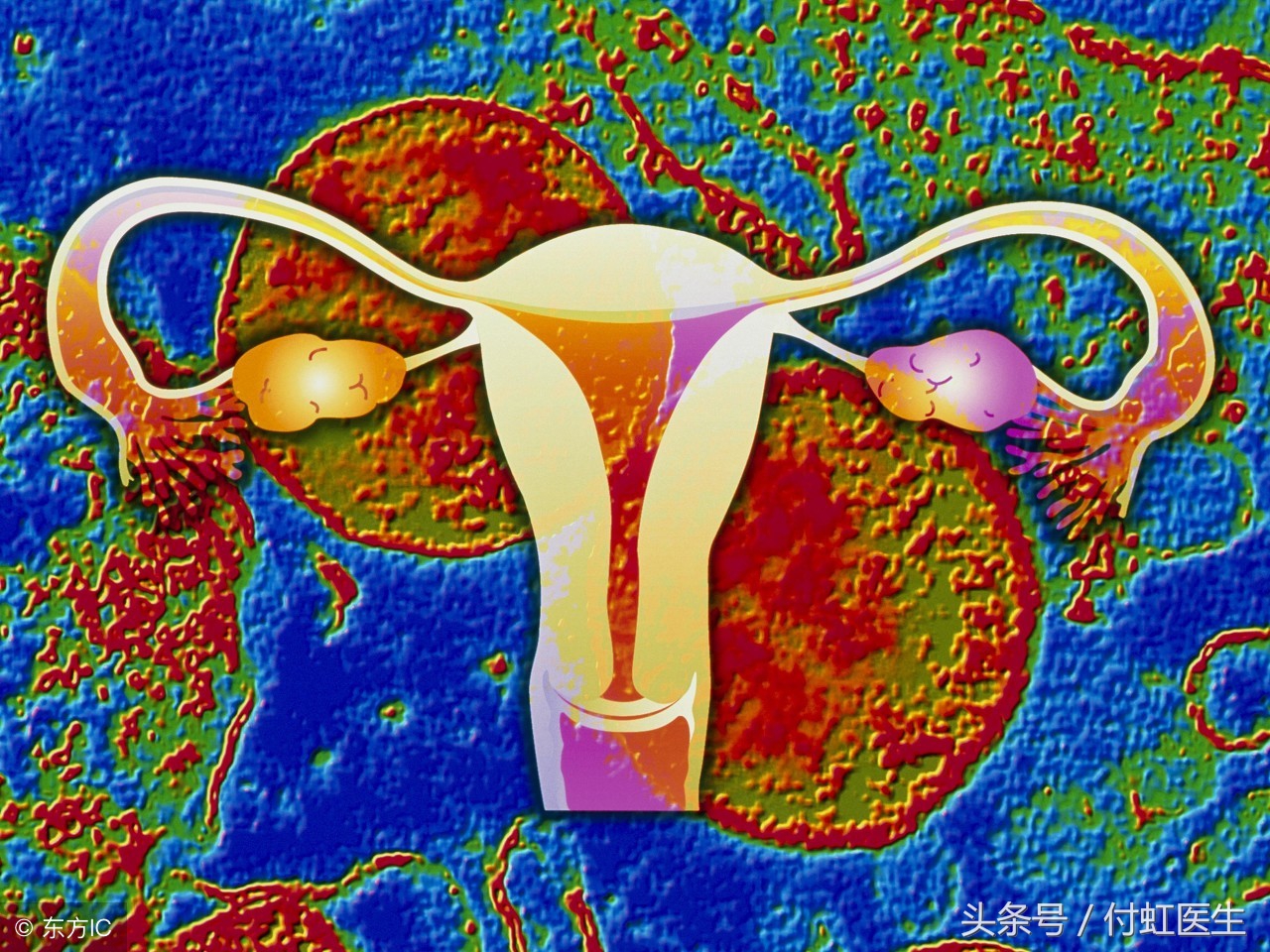 人流术后3天腰疼腹部疼,人流后留下后遗症腰酸怎么办