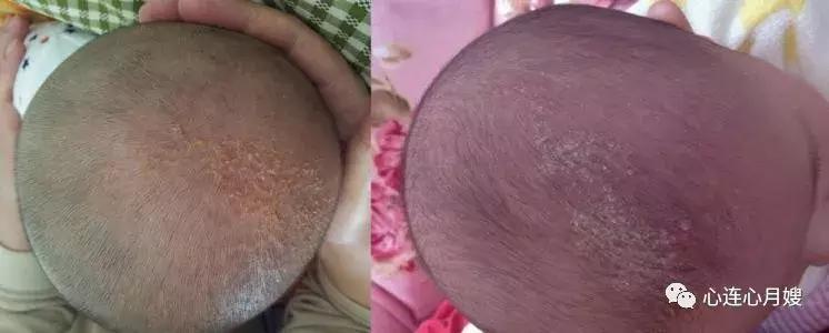 新生儿最重要的护理环节是什么,新生儿照顾的重点是什么