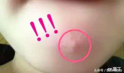 不靠医美拯救垮脸,不靠任何手段改善痘痘