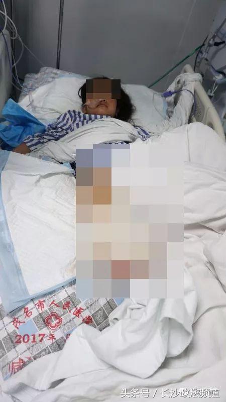 踩到钉子感染破伤风只能截肢,女孩的手被钉子划伤了最后截肢了