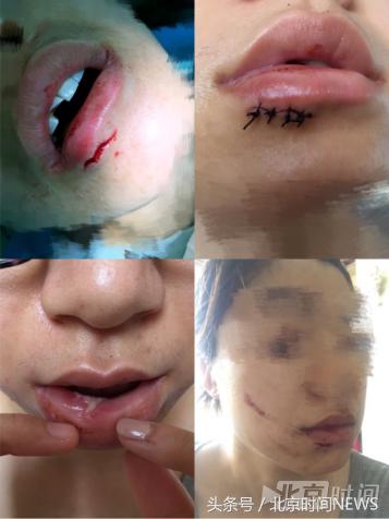 宜家水杯爆裂怎么赔偿,水杯爆裂宜家判赔