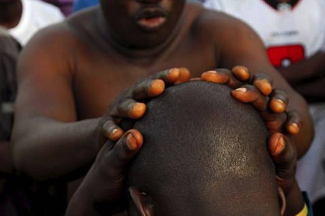 砍下白化病人的四肢入药，猎杀光头男人治病：只有你不敢想，没有巫医做不到