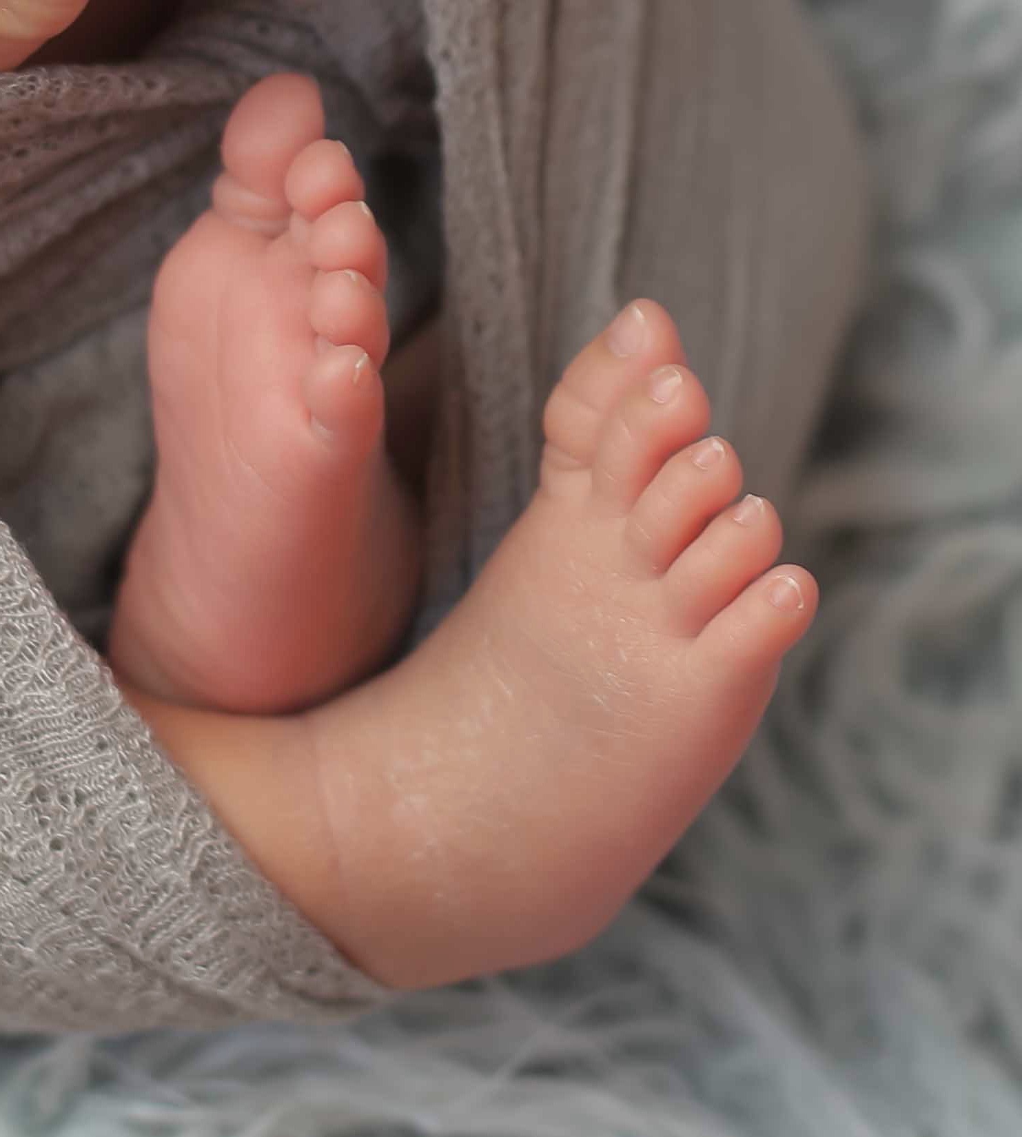 婴儿晒黄疸正确方法,婴儿黄疸高有危害吗