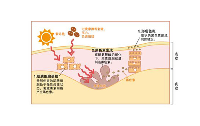 那些年走过的护肤弯路,我们的追求是让护肤少走弯路