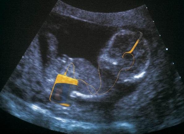 鉴定胎儿性别的四种方法，哪种更准？