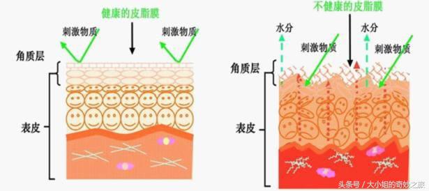 肌肤敏感两大步骤轻松调理好肌肤,肌肤敏感怎么办2019