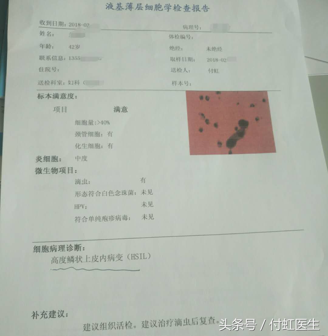 女子到医院查妇科，拿到检验单崩溃流泪，医生给出真相