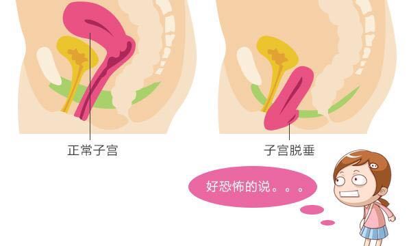 按照这三点做，远离产后阴道松弛！