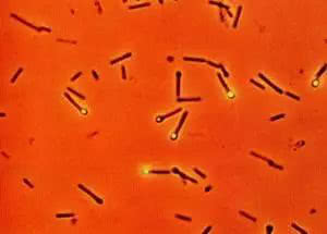 小孩被钉子扎受伤,小女孩被钉子扎伤截肢