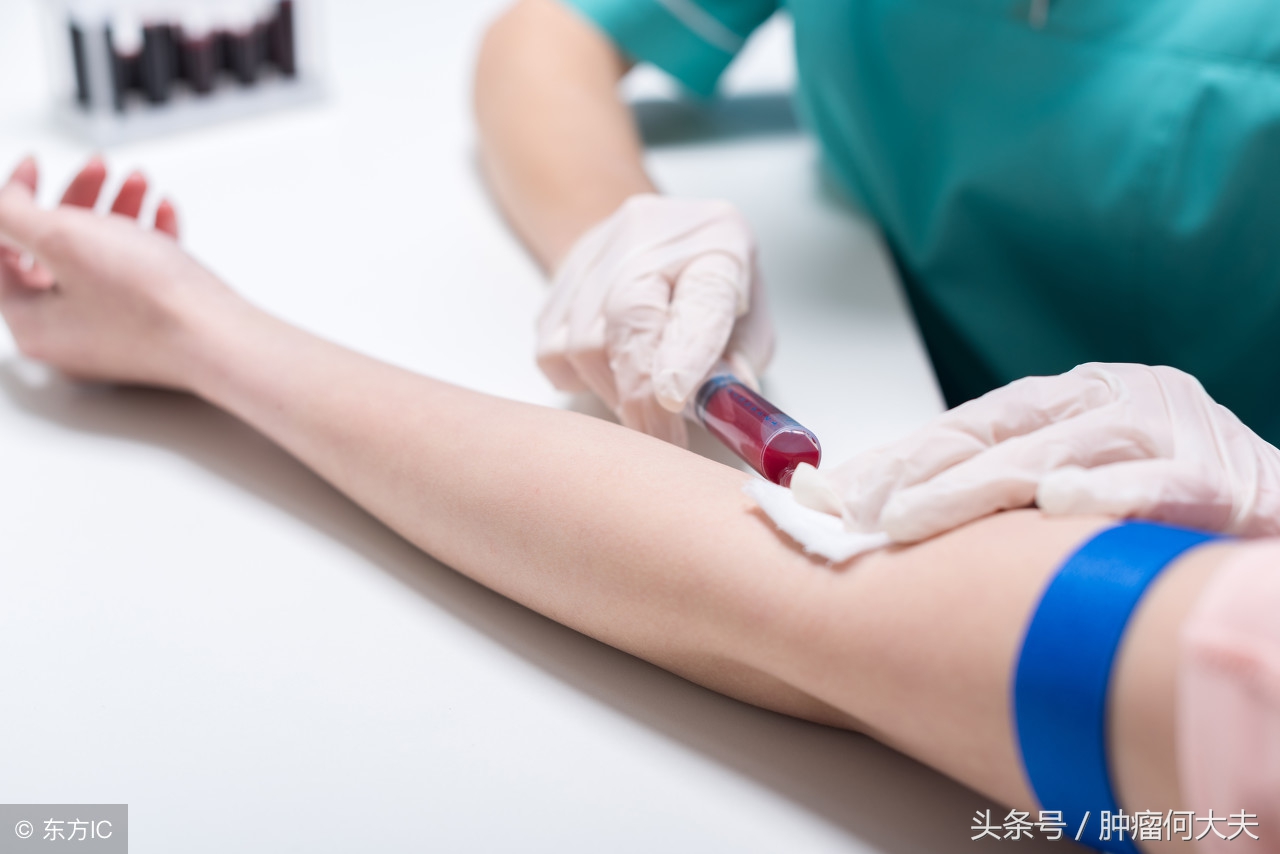 血常规白细胞高还贫血是白血病吗,血常规提示白细胞及血小板减少