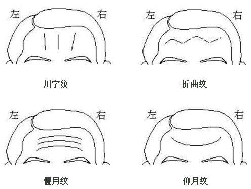额头从发际线到眉毛的纹路,额头有六条长短不一的纹路