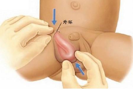 婴儿的护理主要是哪些方面,婴儿的护理方法是维语的