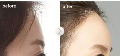 拍照姿势大全站姿侧颜街拍,侧颜拍照技巧影子