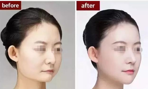 拍照姿势大全站姿侧颜街拍,侧颜拍照技巧影子