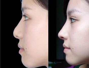 拍照姿势大全站姿侧颜街拍,侧颜拍照技巧影子