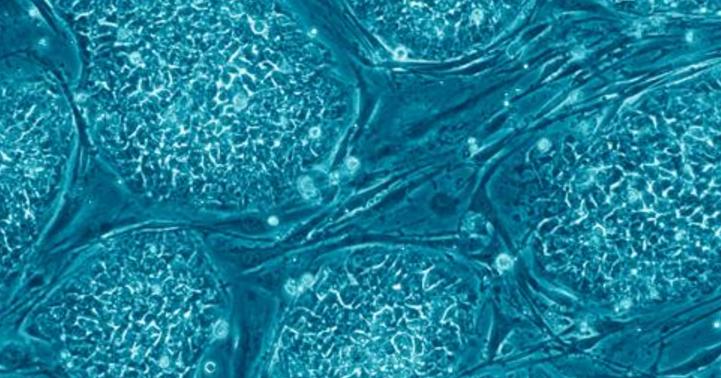 蚕丝跟蛛丝有什么区别,蚕丝与蜘蛛丝区别视频