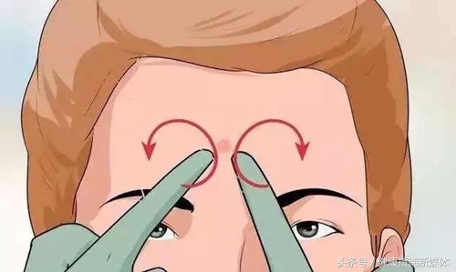 15岁男孩挤青春痘感染,挤痘感染致死案例