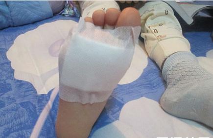 哺乳期感冒可以吃感冒冲剂吗,哺乳期感冒可以贴中药贴治感冒吗