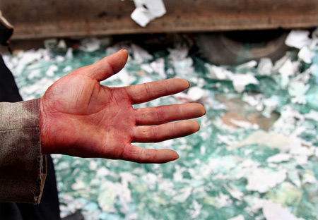 如果心脏被利器刺穿血从哪流出来,碎玻璃扎进肉里会进入血管吗