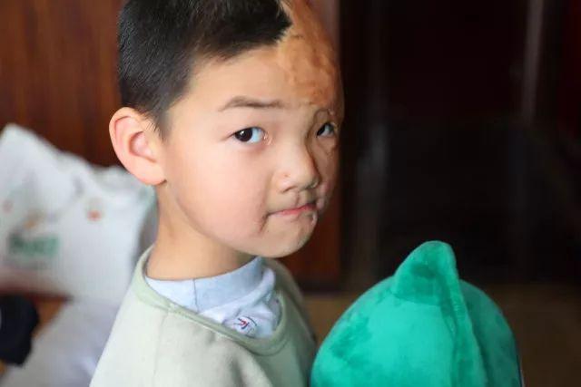 第5场！9958疤痕儿童义诊筛查救助活动（四川筠连站）圆满举办！