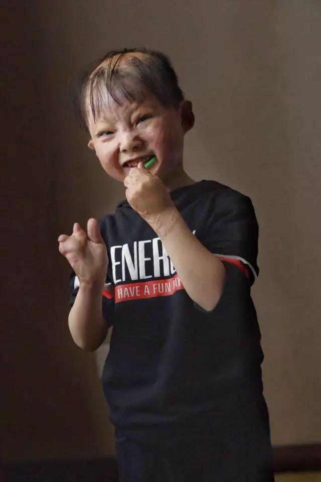 第5场！9958疤痕儿童义诊筛查救助活动（四川筠连站）圆满举办！