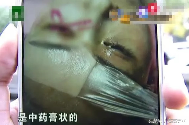 祛斑最有效方法辟谣,十大坑人的网红祛斑产品