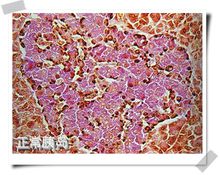 空腹血糖和餐后血糖都高吃什么药,空腹血糖和餐后血糖检测多少钱