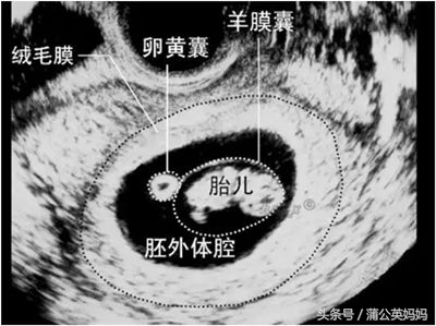 孕期指南:0到38周孕妈妈产前必做的检查项目,太实用了,收藏了