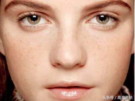 祛斑最有效方法辟谣,十大坑人的网红祛斑产品