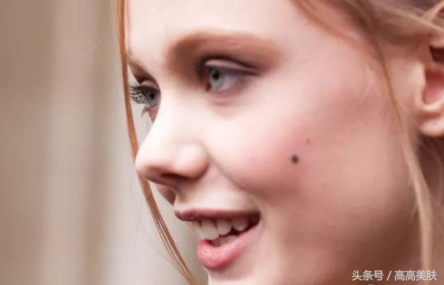 祛斑最有效方法辟谣,十大坑人的网红祛斑产品