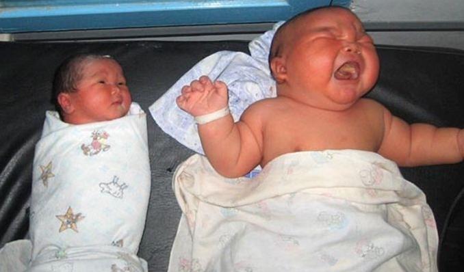 你懂巨婴，未必懂得“巨大儿”？