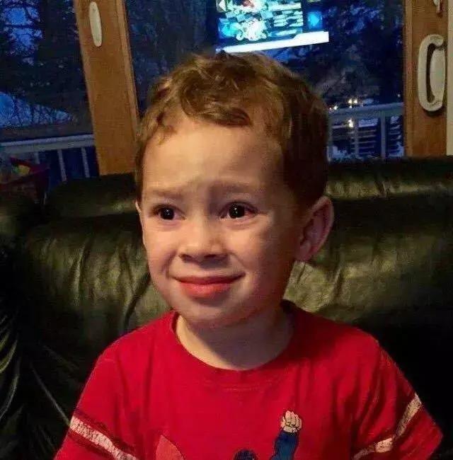 脸盲症是种怎样的体验,脸盲症是看到的每个人都一样吗