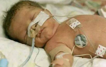 死胎、畸形、*品毒**宝宝，吸毒后怀孕，宝宝会有哪些症状