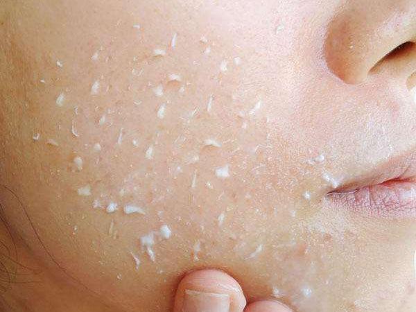 毛孔粗大怎么办教你一招收缩毛孔,毛孔粗大收缩毛孔最有效的方法