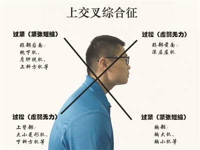 青少年驼背怎么办？这些动作应该练