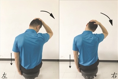 青少年驼背怎么办？这些动作应该练
