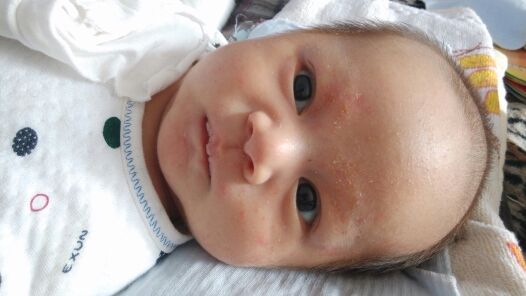 孕妇吃什么导致胎热,导致胎毒和胎热的食物有哪些