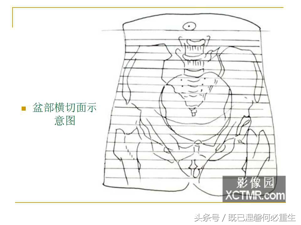 男性盆腔断层解剖图谱,女性盆腔核磁断层解剖