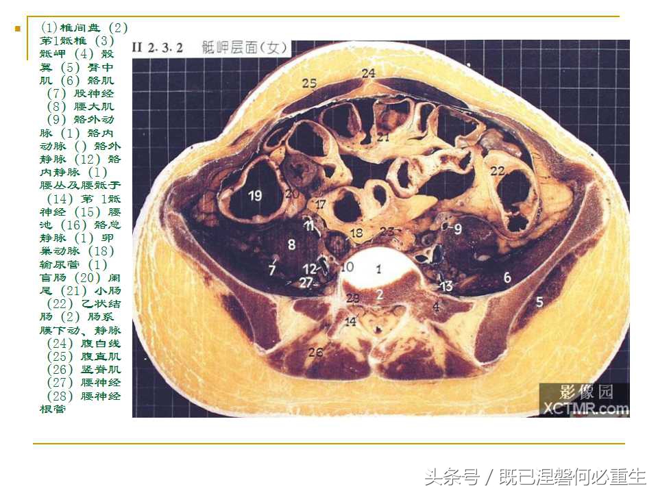 男性盆腔断层解剖图谱,女性盆腔核磁断层解剖