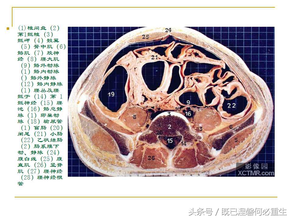 男性盆腔断层解剖图谱,女性盆腔核磁断层解剖