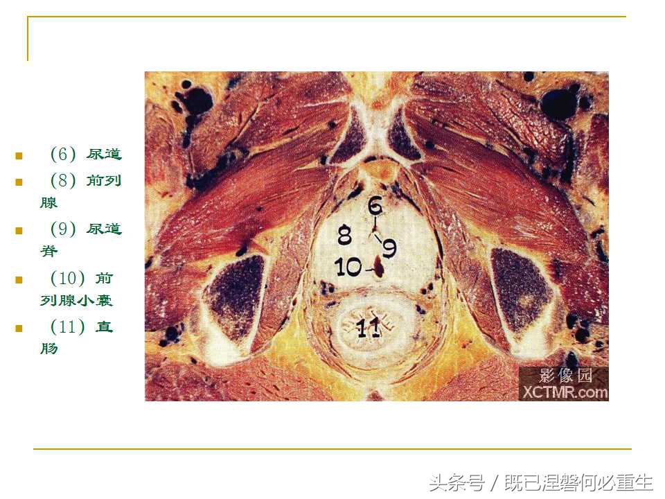 男性盆腔断层解剖图谱,女性盆腔核磁断层解剖