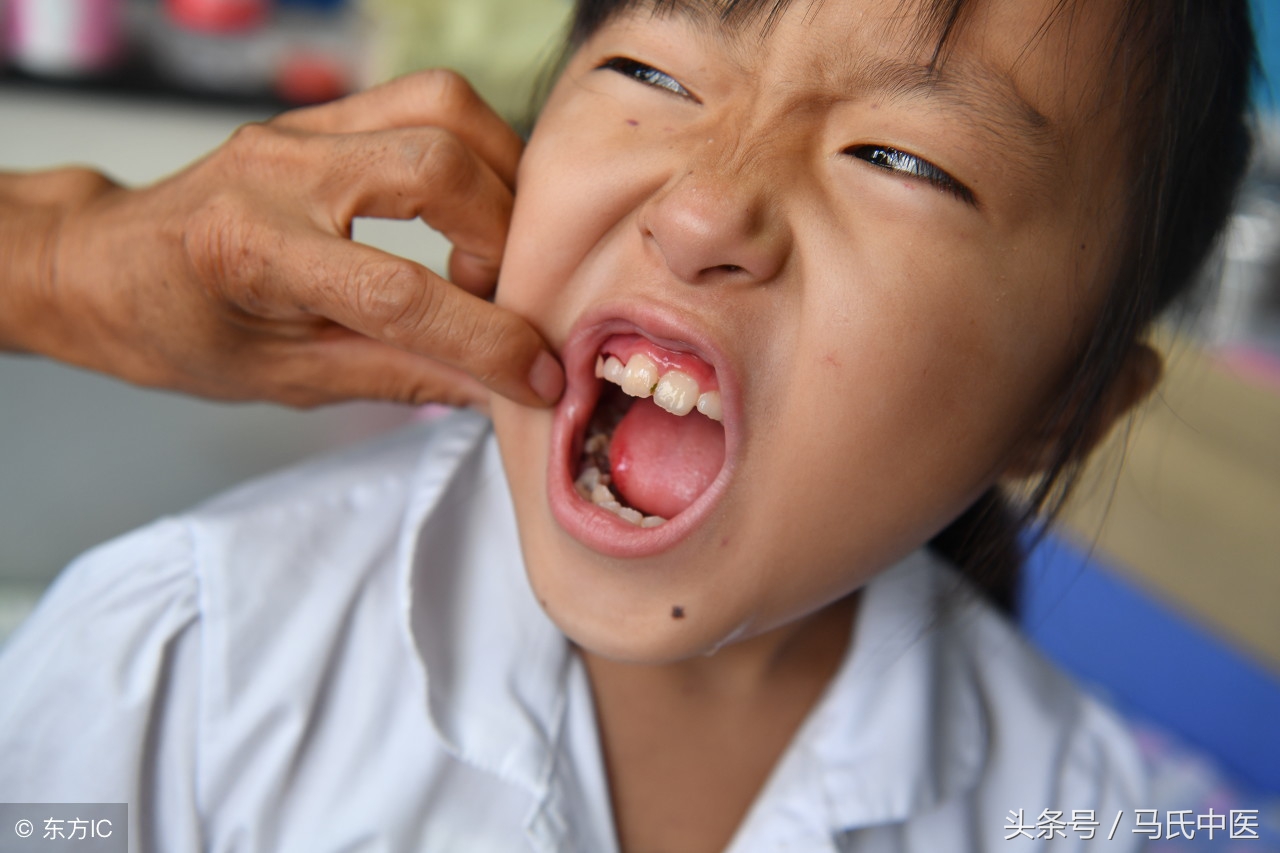 吐血是哪里出血要打针吗,吐血怎么回事看什么科
