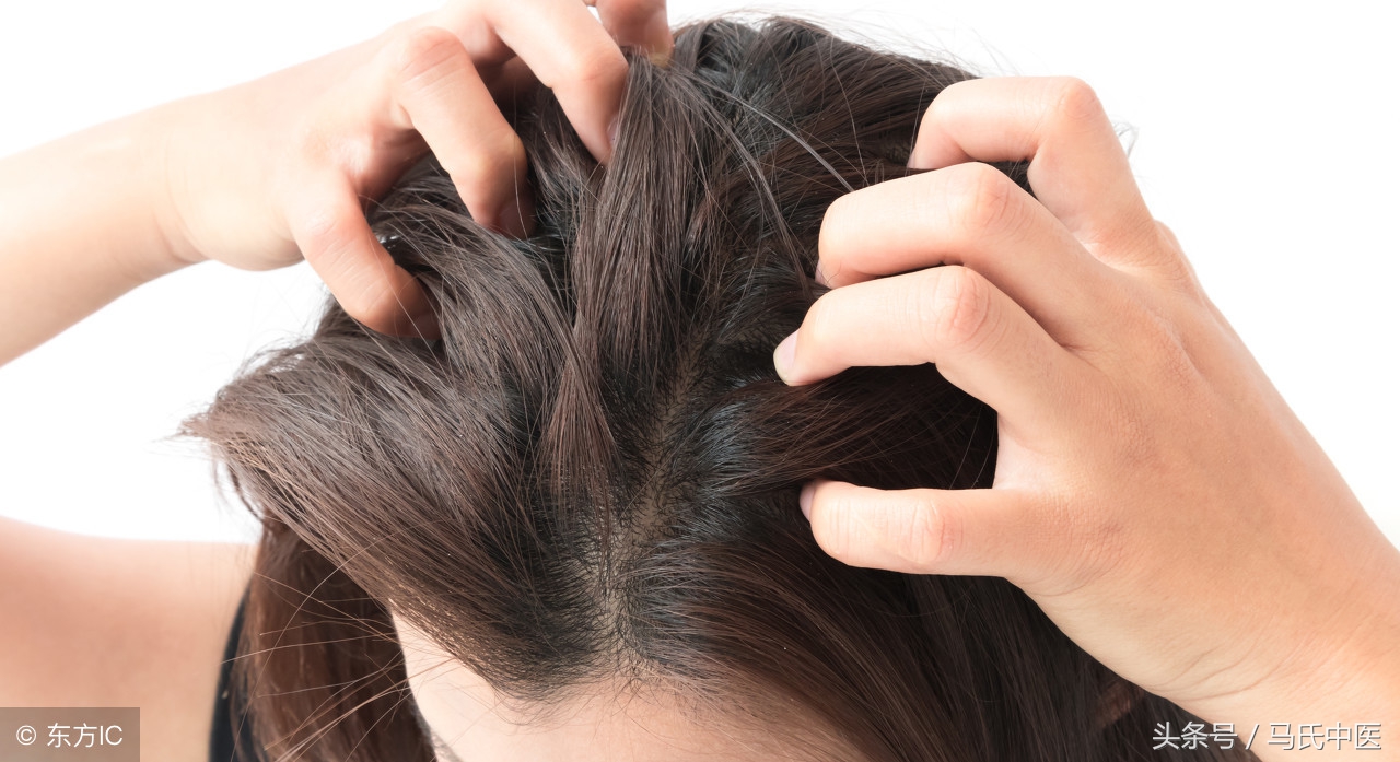 头皮脱屑中医治疗方法,头皮有结痂有头屑的中医治疗